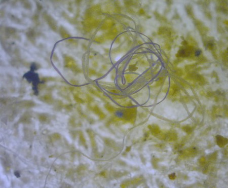 Lecker: Im Mittelmeer kommt ein Plastikpartikel auf zwei Plankton-Kleinlebewesen. (Foto: M.Danny25, Wikimedia)